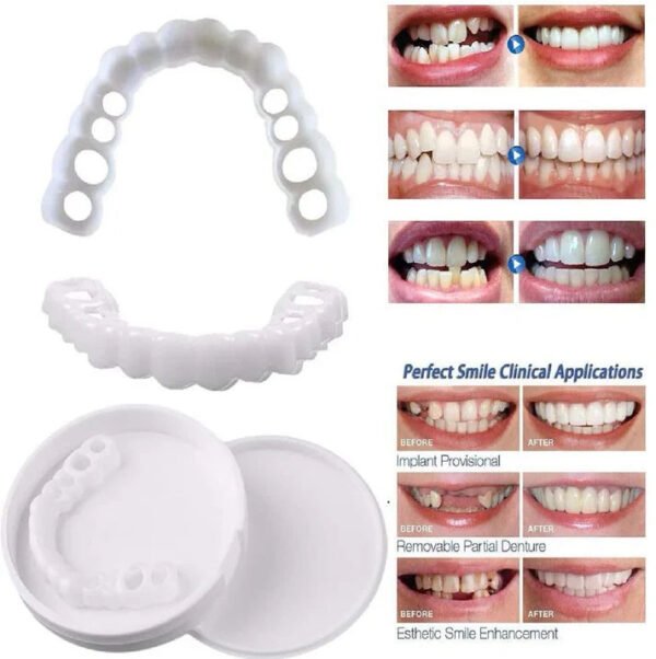 SnapOn Smile Dental Veneers - Image 3