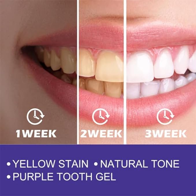 Teeth Whitening Toothpaste - Image 3