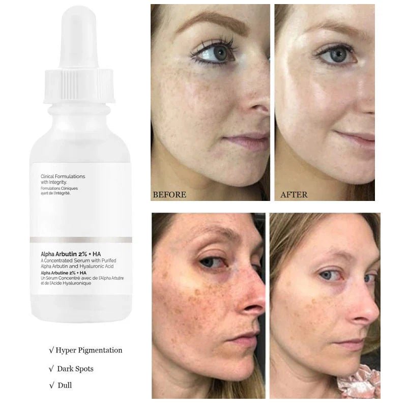 The Ordinary - Alpha Arbutin 2% + HA - Image 4