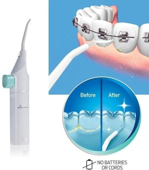 Dental Water Flosser - Image 3