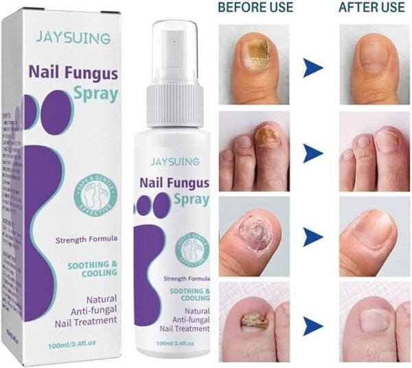 Nail Fungus Spray - Image 6