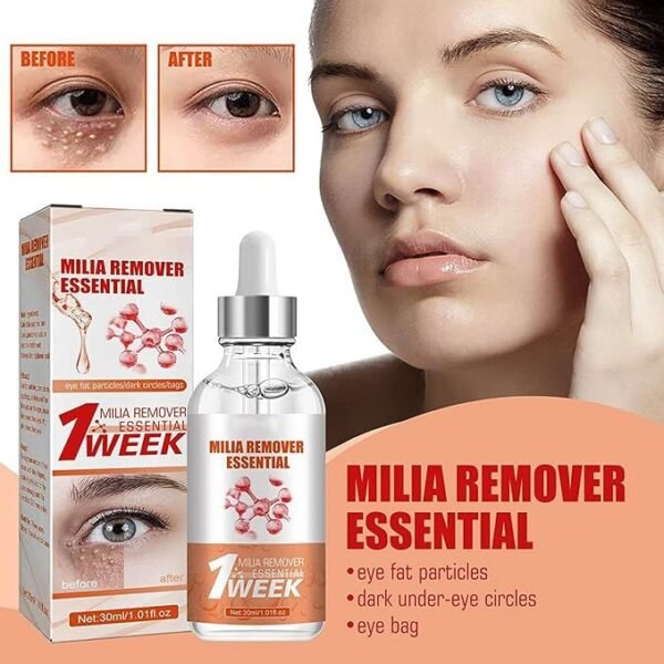 Smooth Milia Remover Serum (30ml) - Image 2