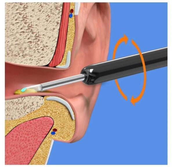 Earwax Removal Kit - Image 2