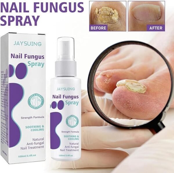 Nail Fungus Spray - Image 4